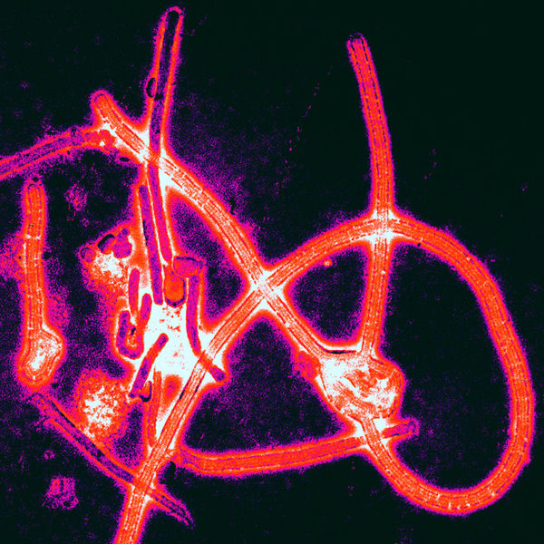 Ebola under a microscope.