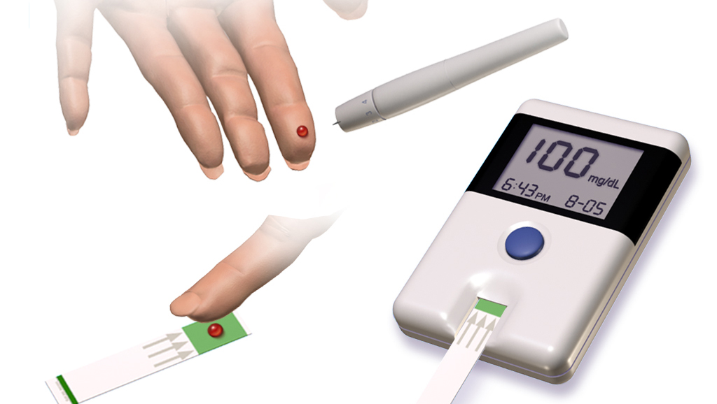 Illustration showing glucose monitoring of diabetes patient