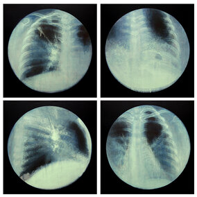 X-ray photographs